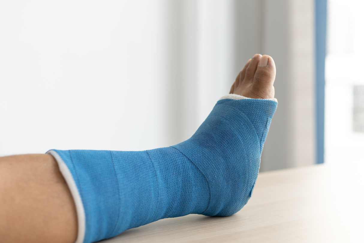 Splint